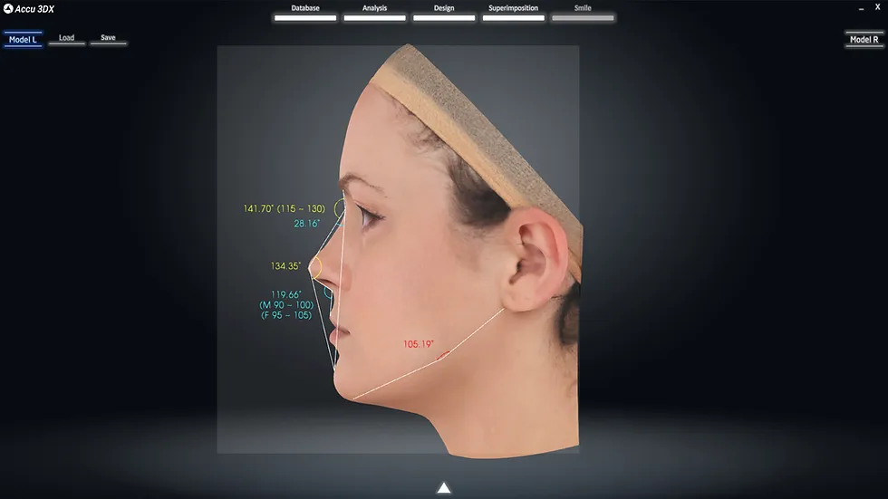 Face Angle