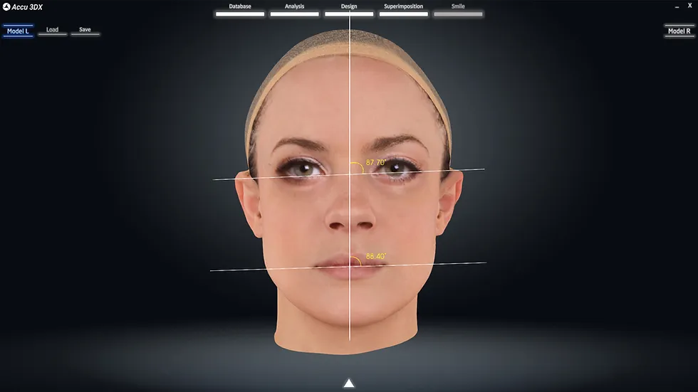 Natural Head Position