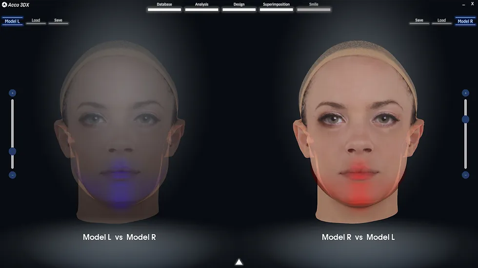Mirror Analysis